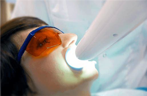 Understanding the Causes of Teeth Sensitivity Stevenage