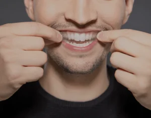 Impact of Home Kits Stevenage versus Professional Teeth Whitening Treatments