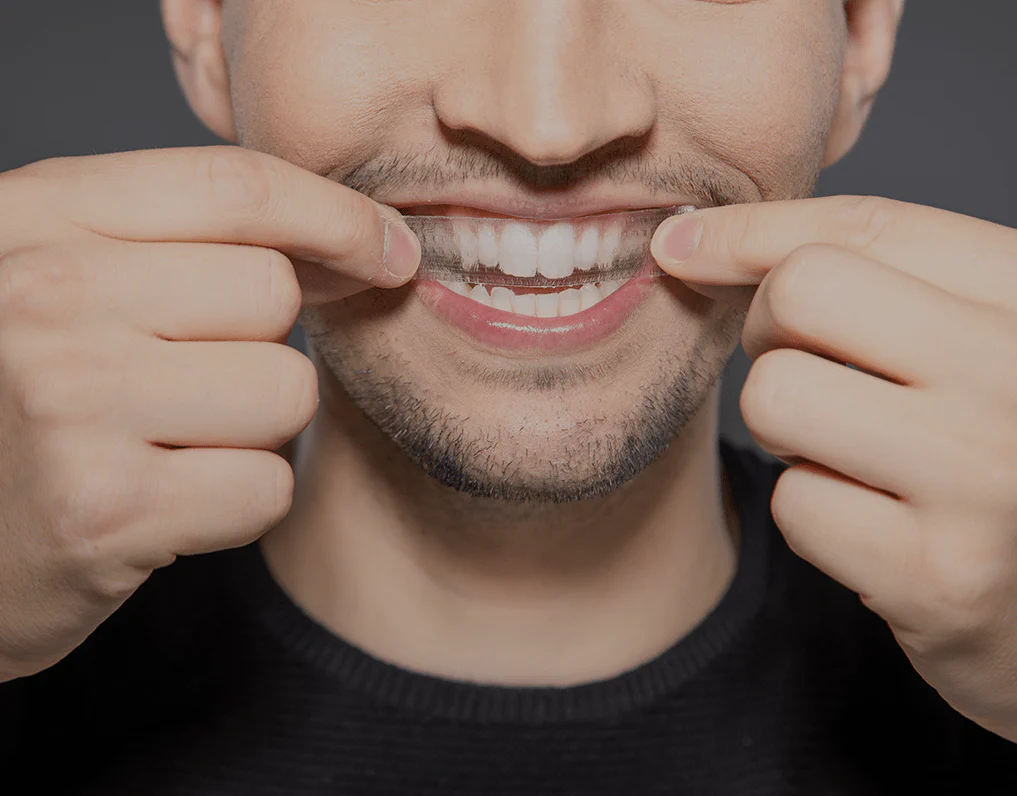 How Are Invisible Aligners Changing Orthodontic Treatments Stevenage?