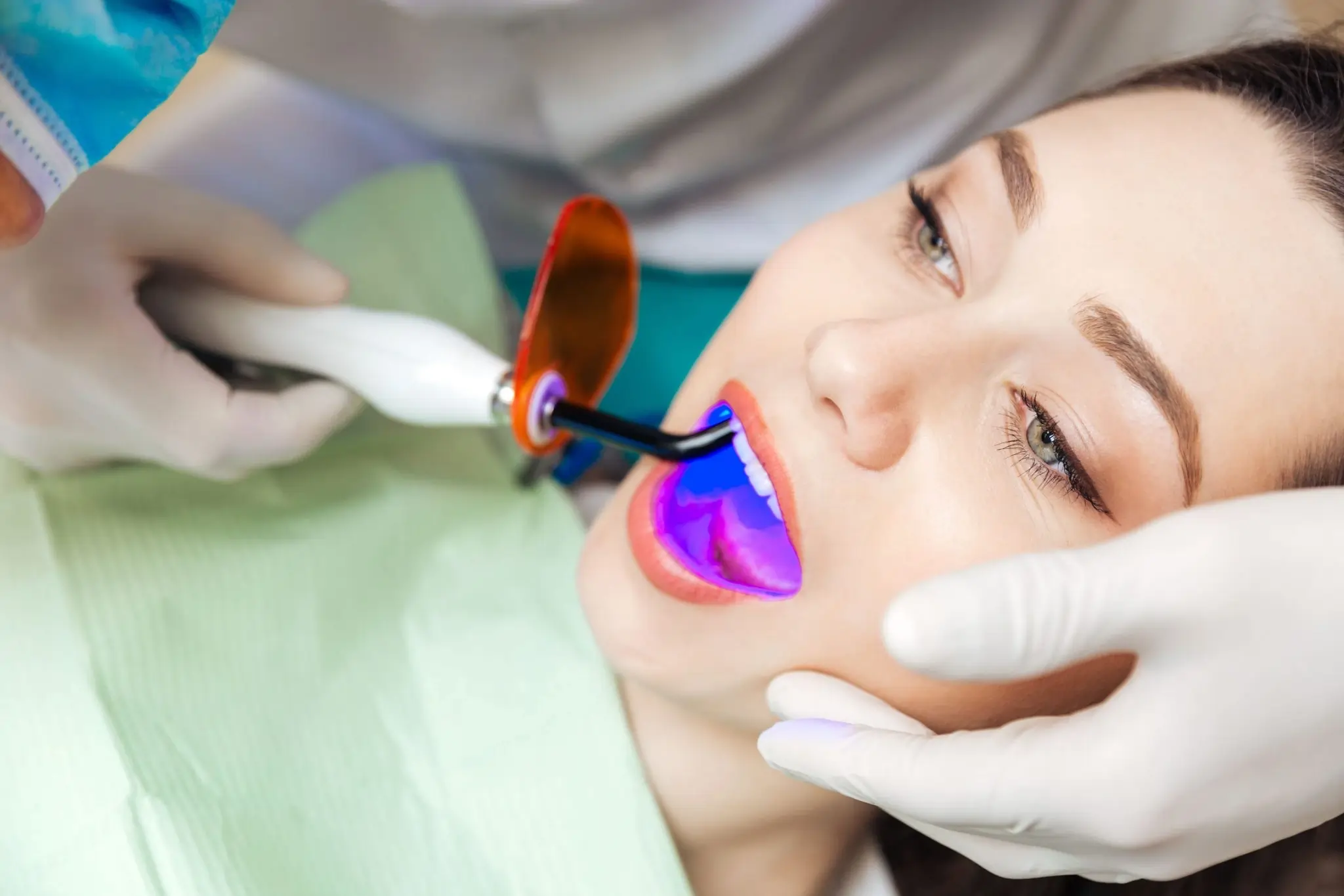 How Long Can You Expect Laser Teeth Whitening Results to Last Stevenage?
