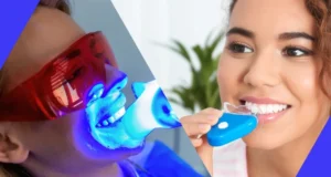 Impact of Home Kits Stevenage versus Professional Teeth Whitening Treatments