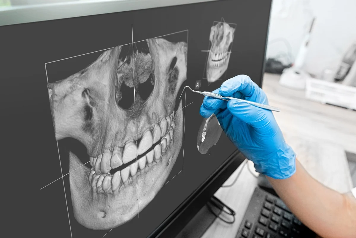 Key Benefits of 3D Printing for Patients and Dentists Stevenage