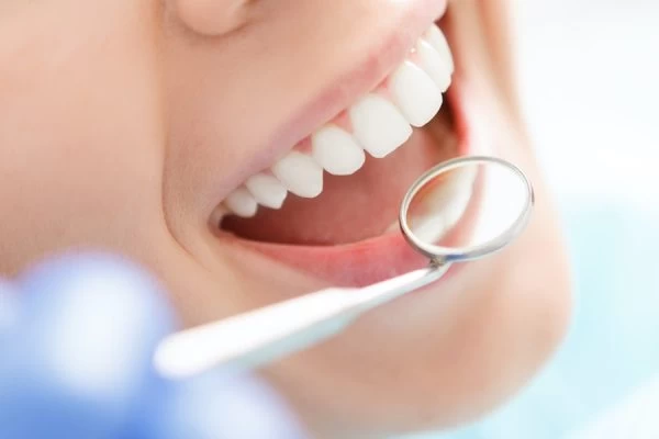 How to Maintain Your Whiter Smile After Treatment Stevenage