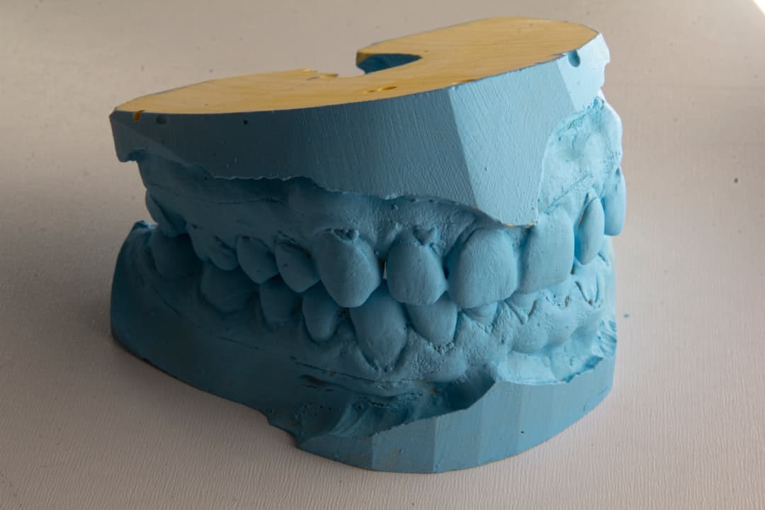 How Do Dental Implants Improve Jawbone Health and Oral Function Stevenage?