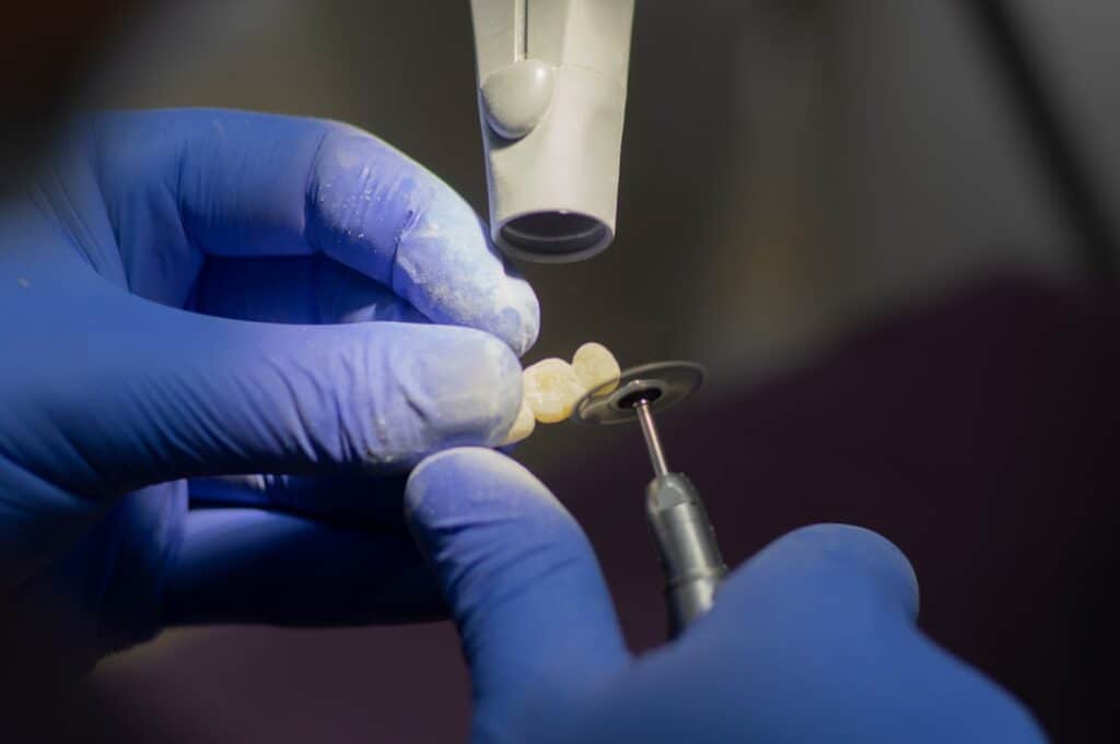 Customised Dental Solutions: Crowns, Aligners, and Implants Stevenage