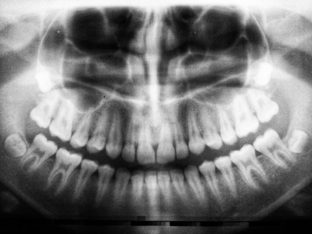 The Future of 3D Printing in Oral Healthcare Stevenage